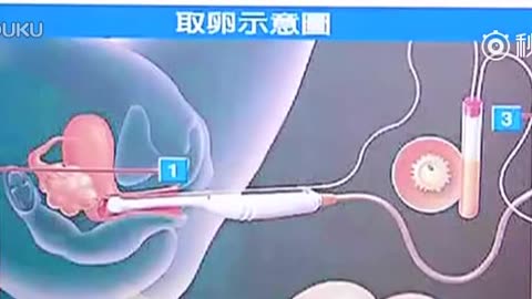 2024南京市省妇幼借卵试管代生费用费用大约多少